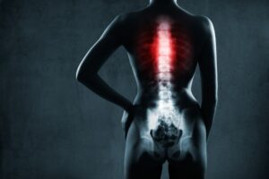 back injury lawyer in Green Bay, WI