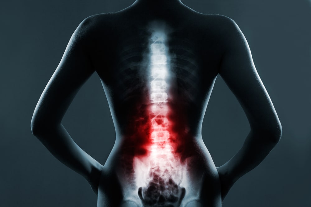 Back Injury Lawyer Racine, WI